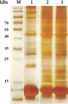 Comparative Analysis of Erythrocyte Proteomes of Water Buffalo, Dairy Cattle, and Beef Cattle by Shotgun LC-MS/MS